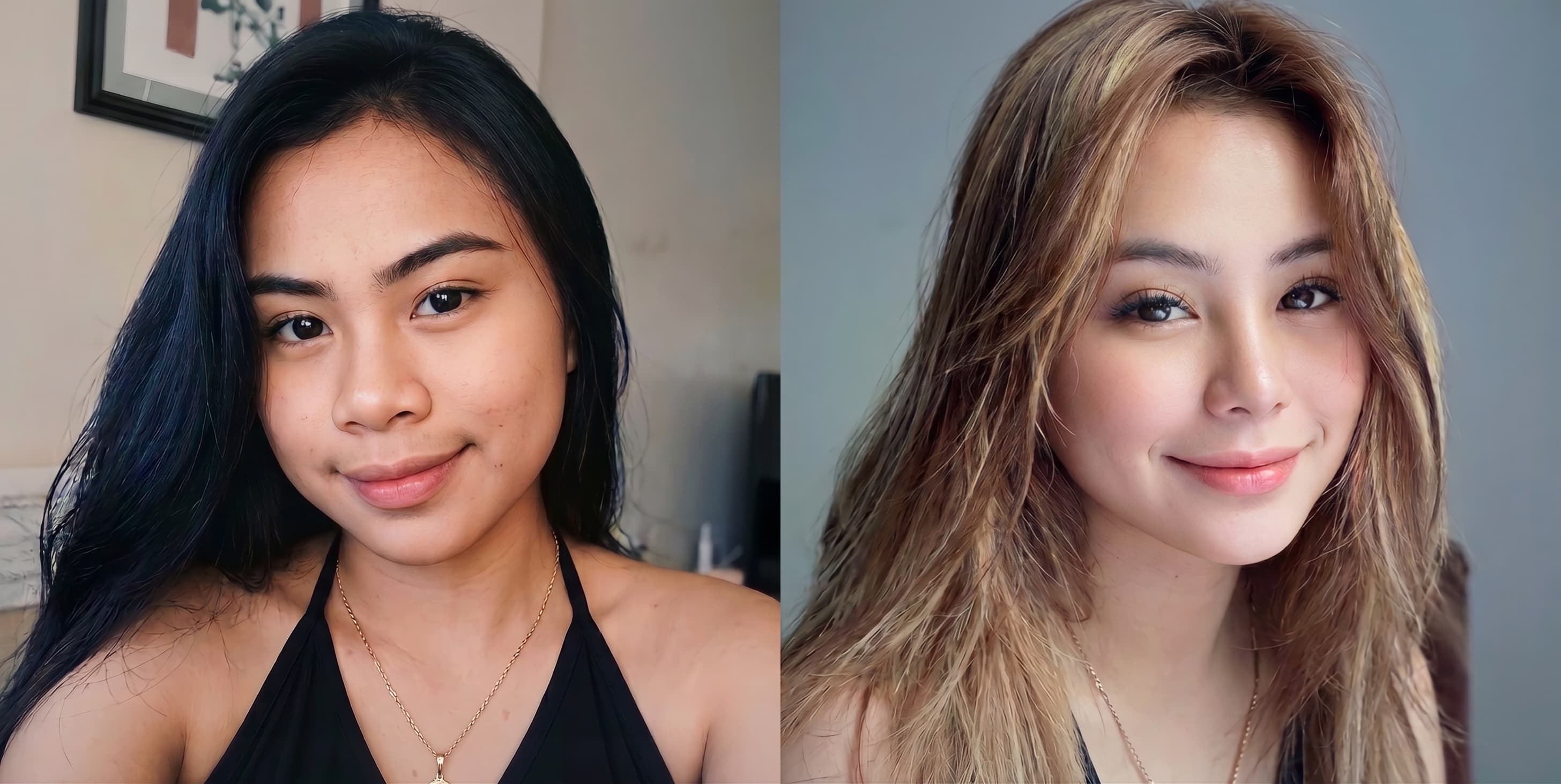 Patient one before and after alar base refinement comparison